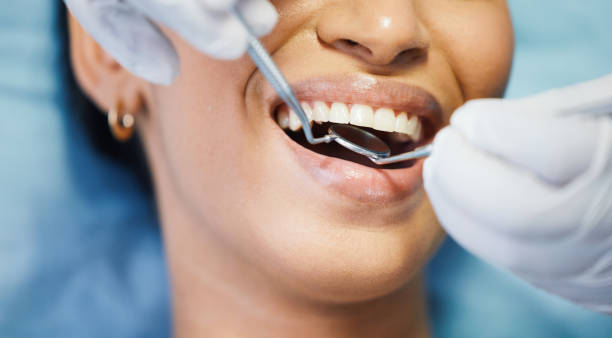 Best Emergency Treatment for Oral Infections in Lemon Grove, CA